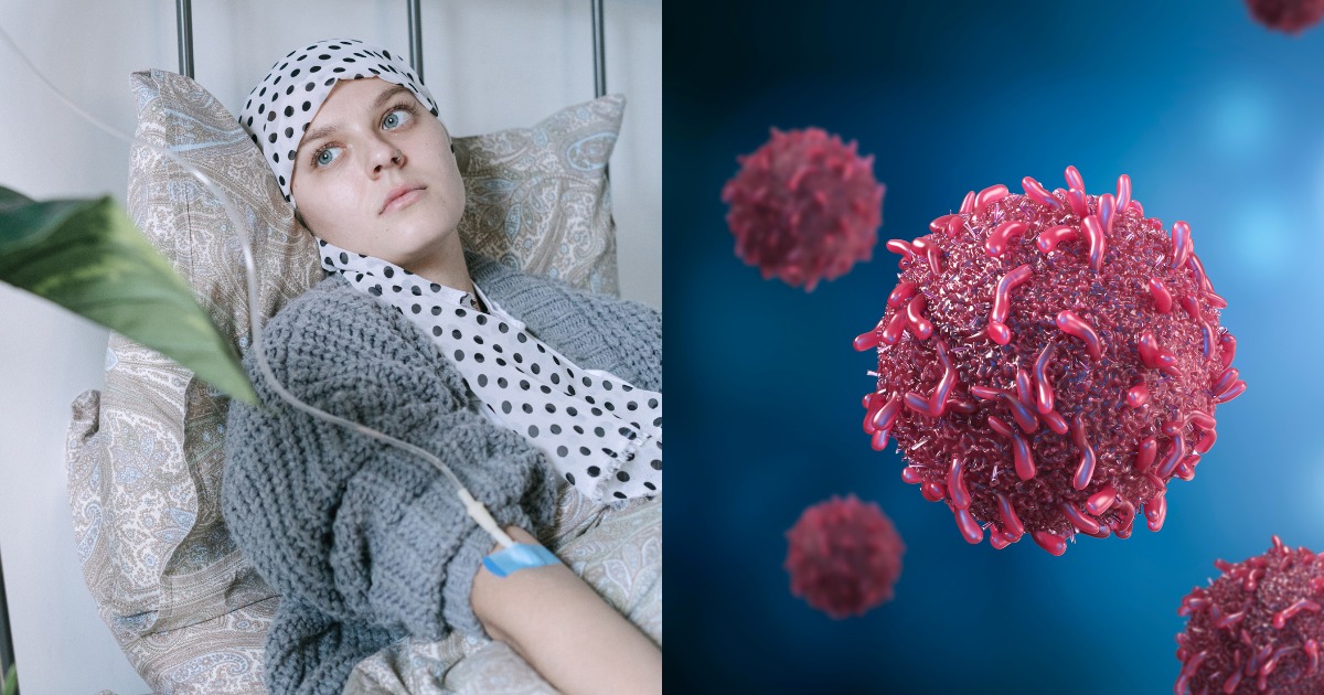 4 Alarming Cancer Trends in 2025