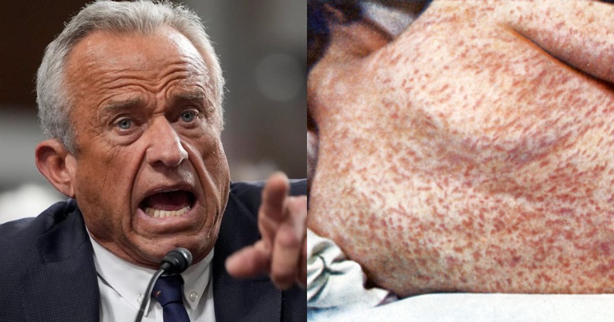 Father of Measles-Stricken Daughter Slams RFK Jr. for Keeping Silent Over Vaccination