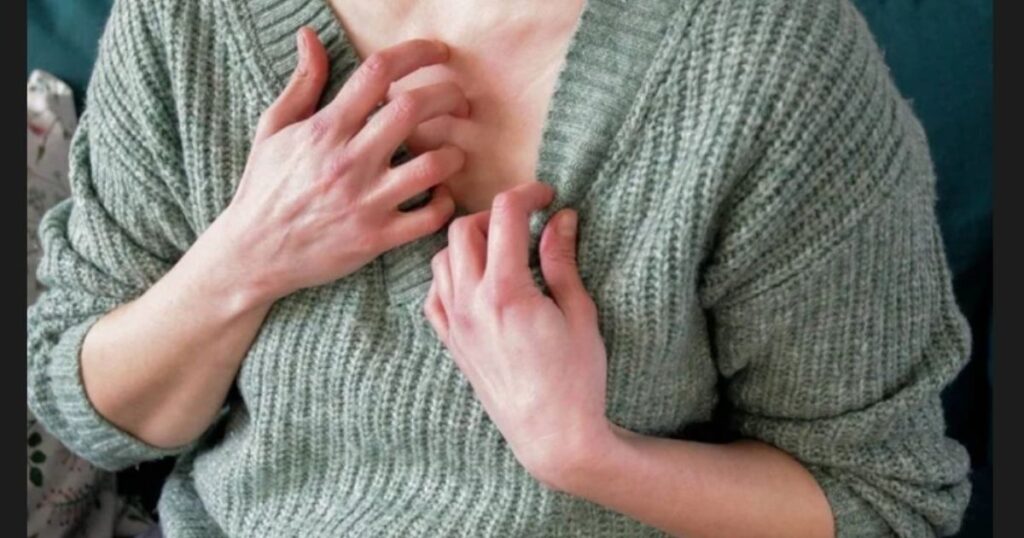 Itchy Skin Could Be Linked to Toxic Liver