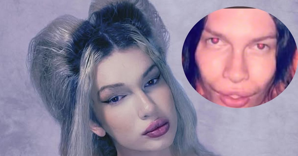 TikToker Jolene Dawson spent a huge amount of money in surgery to look like a cat