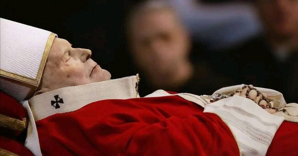 What’s That Mark on Pope Francis’ Face Bruise Sparks Speculation and Theories