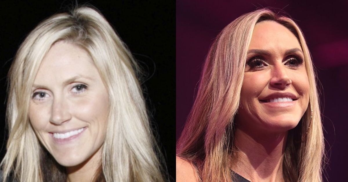 Side-by-side images of Lara Trump — left: earlier photo via @LePapillonBlu2 on X, possibly before cosmetic procedures; right: recent image by Gage Skidmore via Wikimedia Commons.