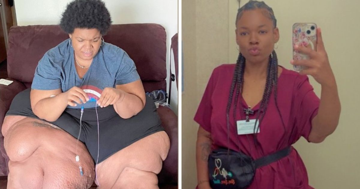 Woman shares how a diagnosis helped her reduce weight