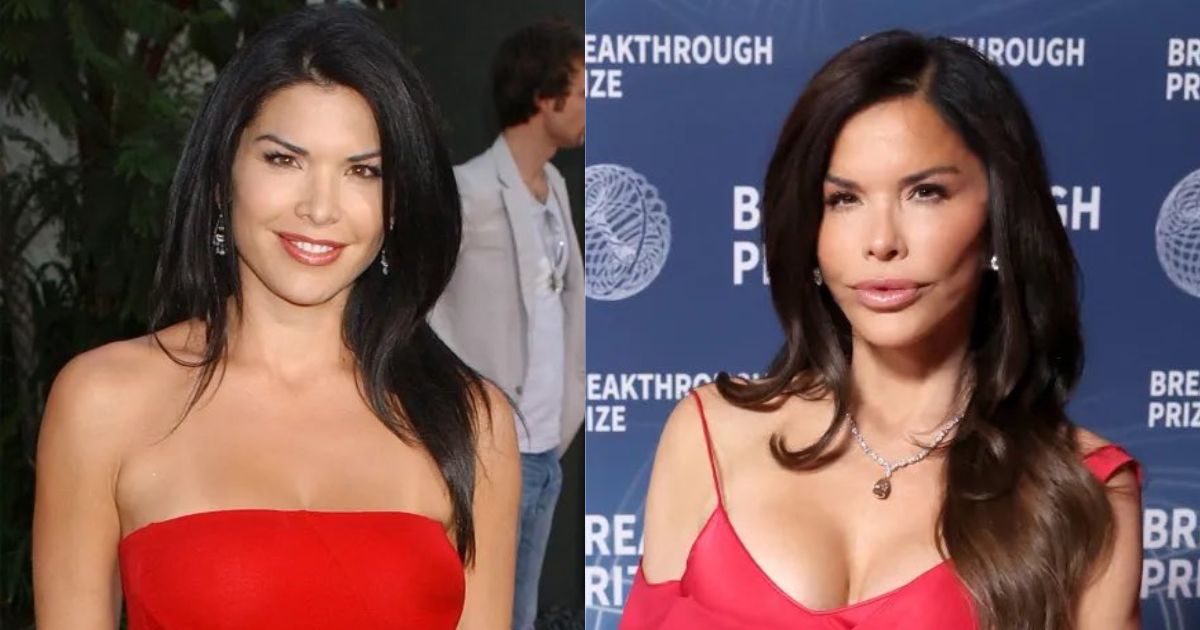 Lauren Sanchez before and after the alleged plastic surgery